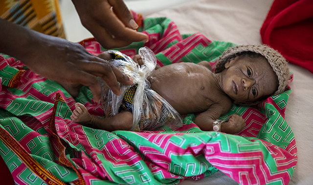 An premature baby gets special care in Sierra Leone.